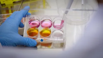 Hand in einem Schutzhandschuh mit Pipette und Laborgerät