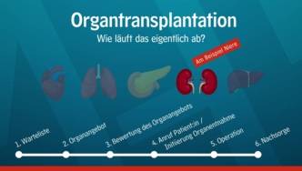 Schaubild zum Ablauf einer Organtransplantation